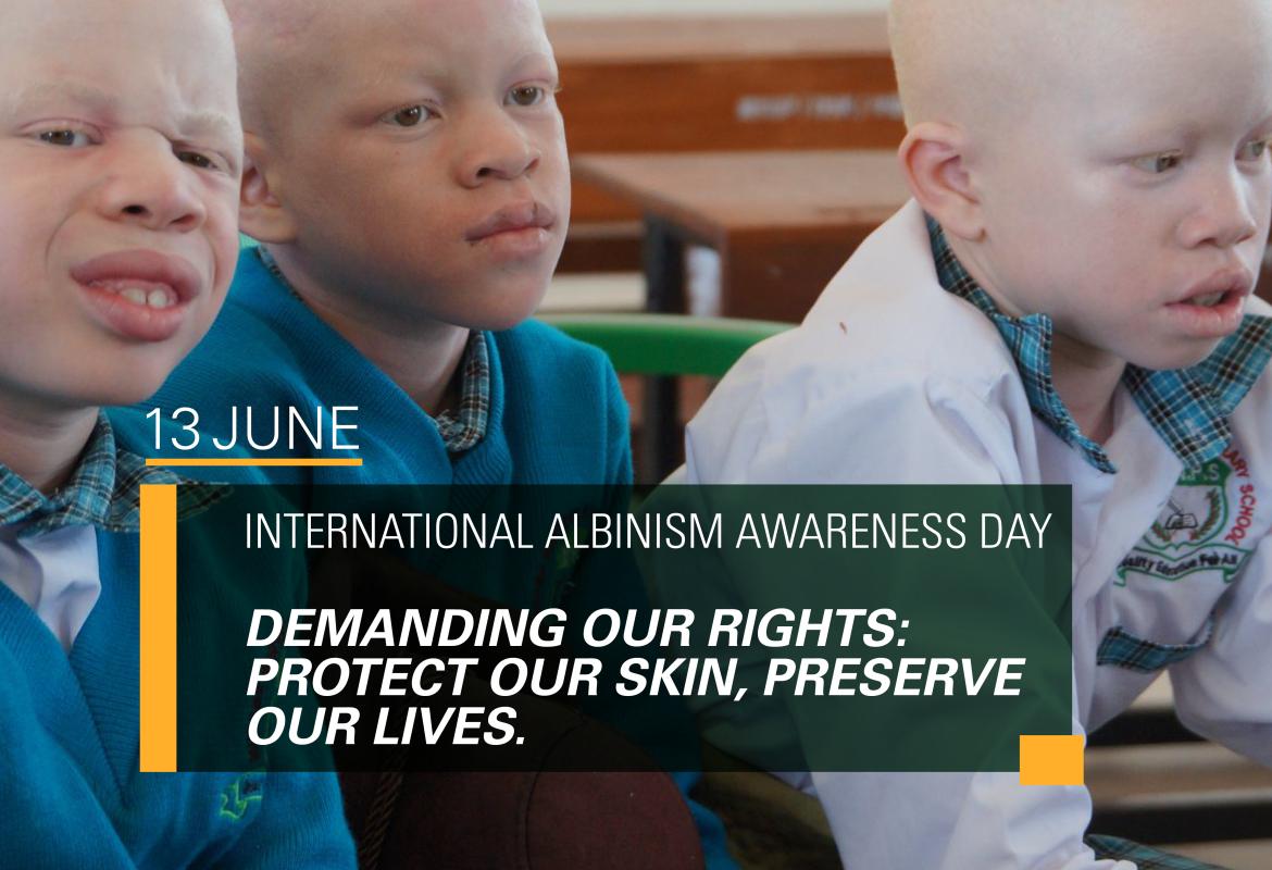 International Albinism Awareness Day Statement 2025